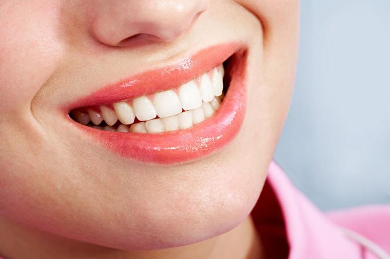 Aesthetic Gum Lift2 | Elite Dental Group