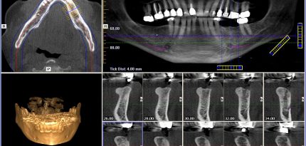 Digital-Dental-Radiology7