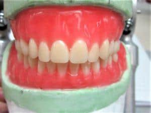 Removable Dentures1 | Elite Dental Group