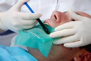 Root Canal Treatment Singapore