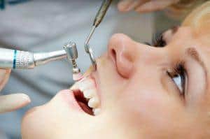 Scaling and Polishing2 | Elite Dental Group