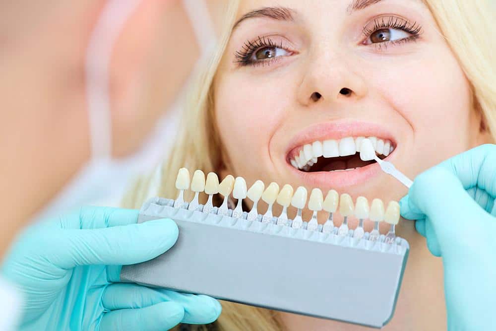 Teeth Whitening2 | Elite Dental Group
