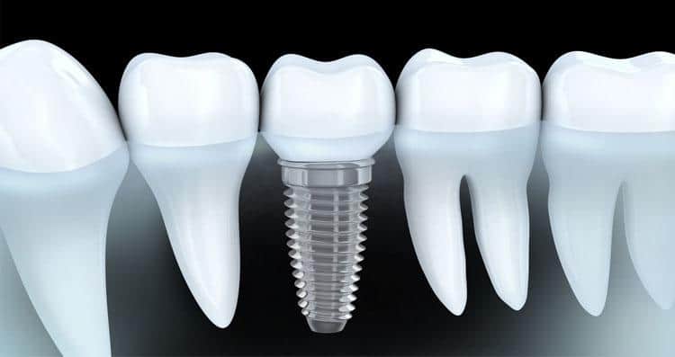 resize 0017 pic1 15.jpg1 | Elite Dental Group