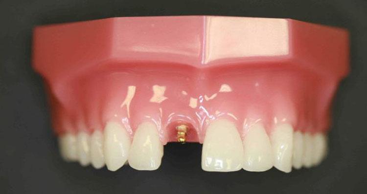 resize 0031 pic1 30.jpg1 | Elite Dental Group