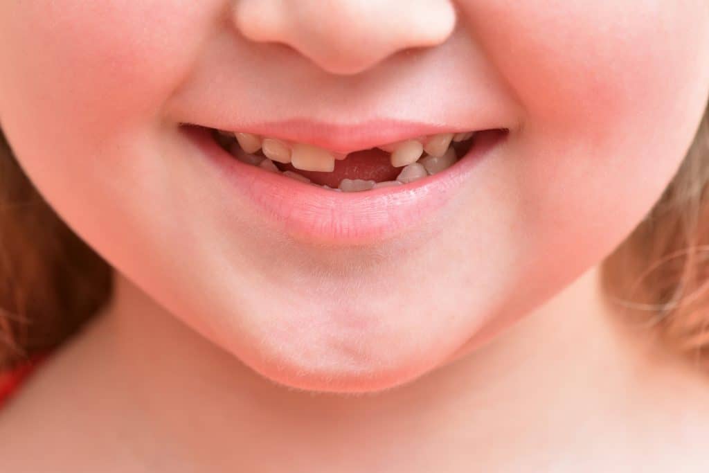 dental implant surgeon in Singapore