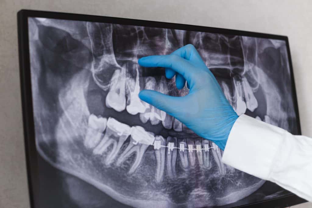 X-ray of mouth for dental examination