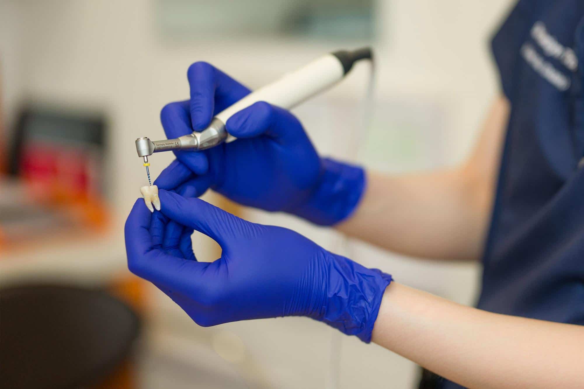 Signs You Need Root Canal Treatment - Elite Dental Group