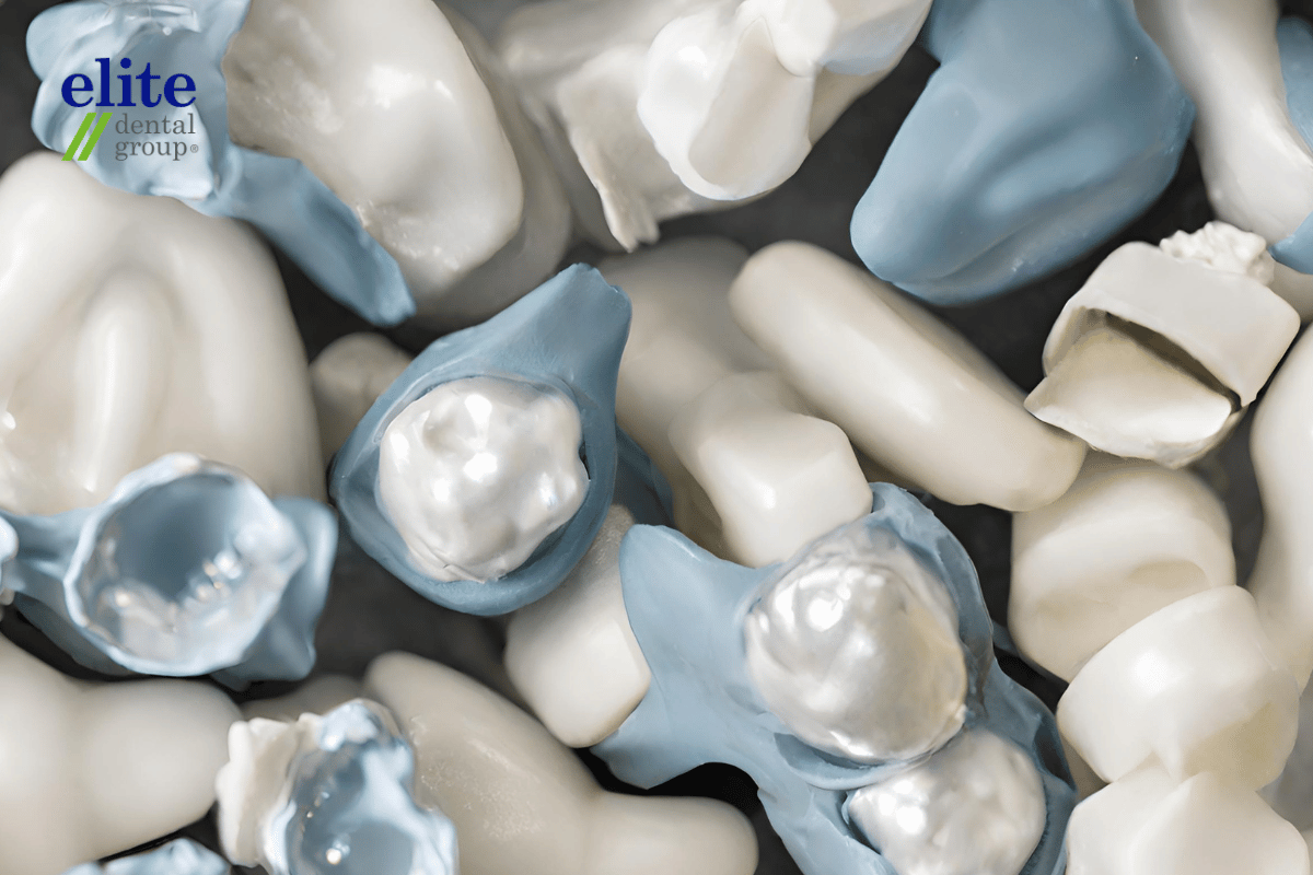 Artistic image of dental fillings or dental amalgam fillings