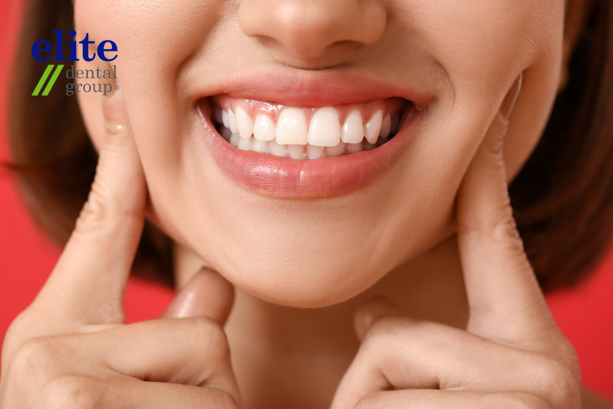 Wider Smiles with Elite Dental Group - Save Money On Dental