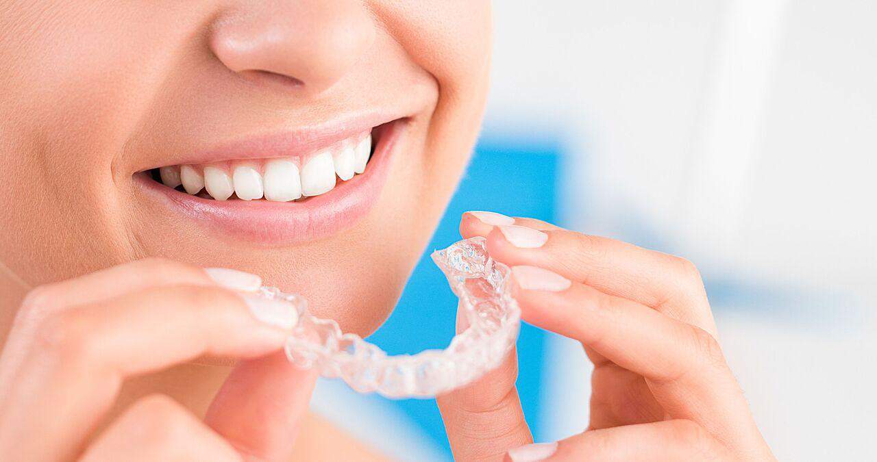 Invisalign1