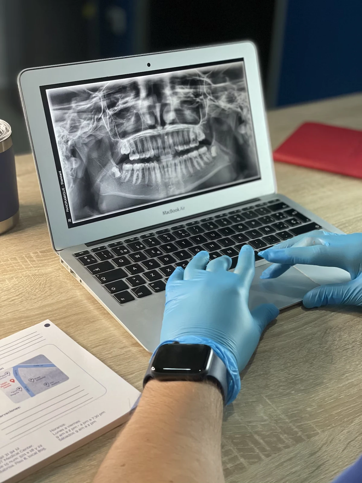 Key-Factors-in-your-Veneer-Treatment-1