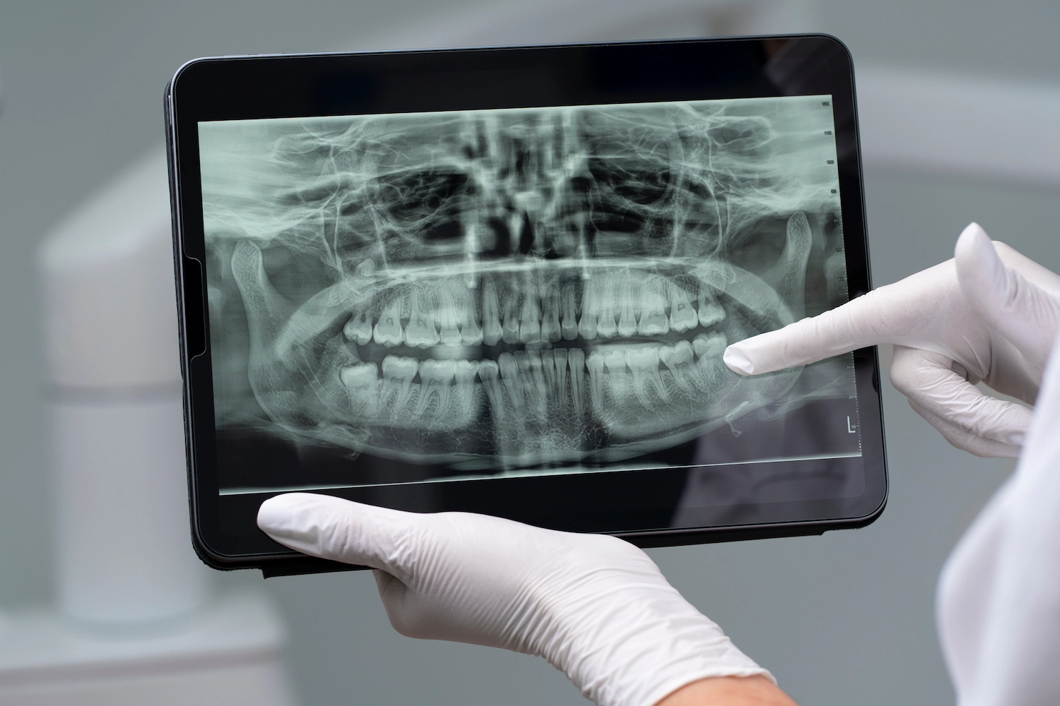 dental-xray