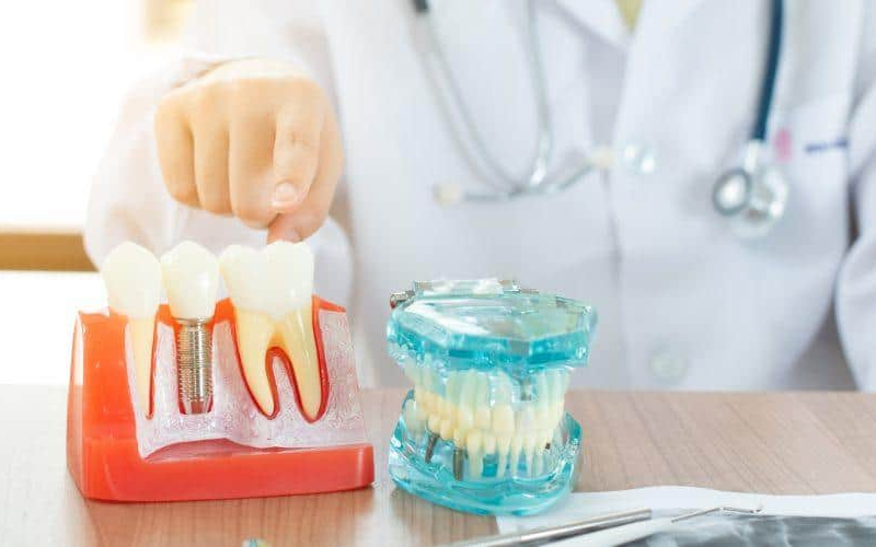 Dentist explaining dental implant parts using models.