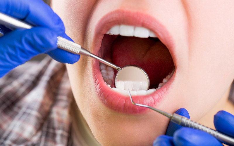 Dentist examining a patient's teeth for crowns or fillings.