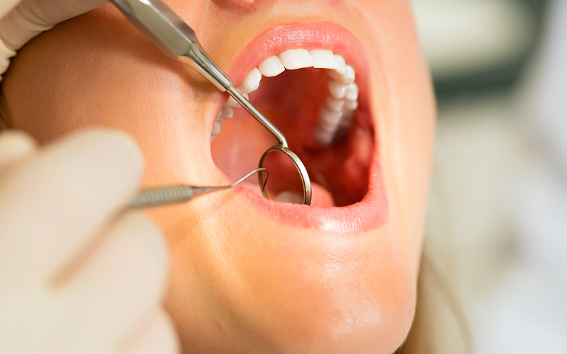 Dentist examining a patient for signs of a cavity.