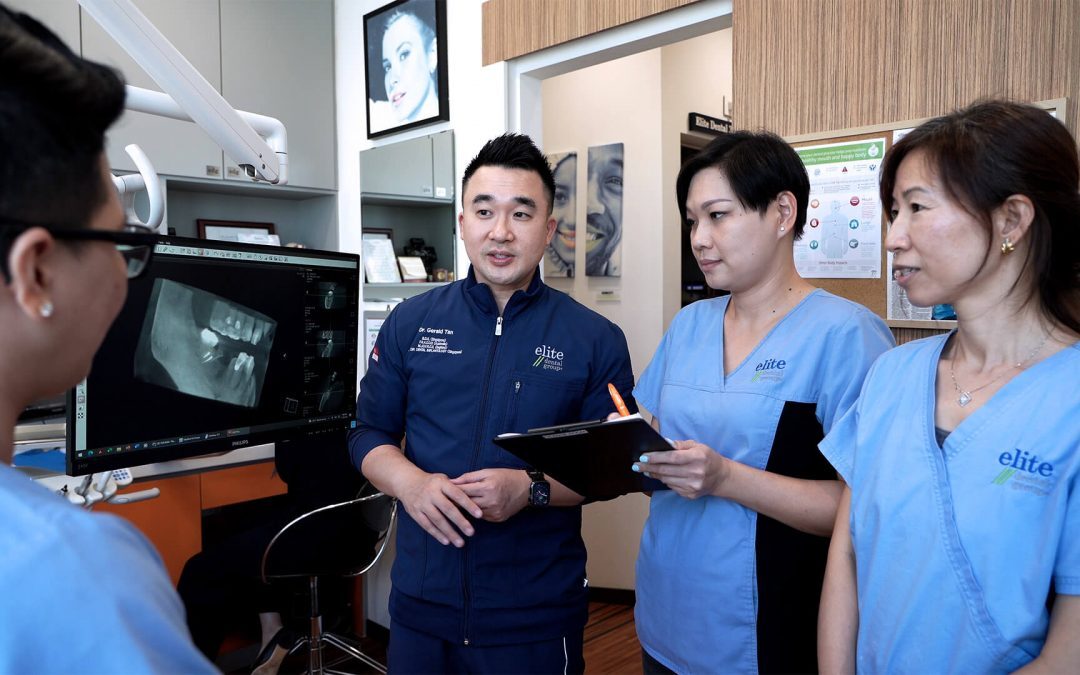 dental consultation at elite dental